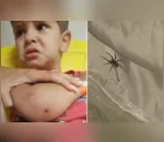 Menino de 2 anos é internado depois de ser picado por aranha